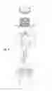 Fig. 05 - Removable pop-up strainer