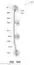 Fig. 28 - Vertical blind assembly