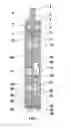 Fig. 02 - DOWNHOLE ANCHORING APPARATUS