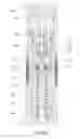 Fig. 06 - Dual stem injection valve
