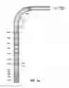 Fig. 02 - Method and apparatus for wellbore fluid treatment