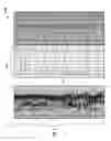 Fig. 04 - Identification of Casing Collars While Drilling and Post Drilling Using LWD and Wireline Measurements