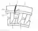 Fig. 01 - METHOD FOR RESTORING A COVER PLATE PRETENSION