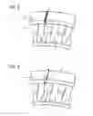 Fig. 03 - METHOD FOR RESTORING A COVER PLATE PRETENSION