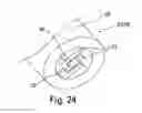 Fig. 16 - Prechamber ignition system