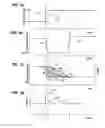 Fig. 04 - Skip fire transition control
