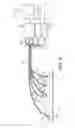 Fig. 04 - Improvements relating to wind turbine sensors