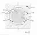 Fig. 23 - Blind fastener