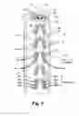 Fig. 10 - Circumferential back-to-back seal assembly with bifurcated flow