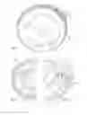 Fig. 07 - DIVIDED TOOTHED WHEEL