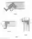 Fig. 03 - Construction site hanging device and use thereof