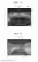 Fig. 05 - Lens for light-emitting device and method of manufacturing light-emitting device package