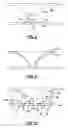 Fig. 12 - Light bulb assembly having internal redirection element for improved directional light distribution