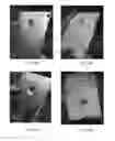Fig. 12 - FLEXIBLE ADHESIVE BALLISTIC SHIELD