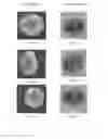 Fig. 06 - Thermography-based method for detecting defects in seals with conductive inner-seals