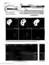 Fig. 30 - PERFORIN 2 DEFENSE AGAINST INVASIVE AND MULTIDRUG RESISTANT PATHOGENS