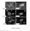 Fig. 02 - Methods for detecting human metapneumovirus
