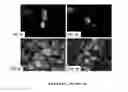 Fig. 03 - Methods for detecting human metapneumovirus