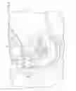 Fig. 06 - Vehicle wheel speed sensor protection structure