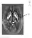 Fig. 01 - SYSTEM AND METHOD FOR LOCATING AND QUANTIFYING A BIOMARKER FOR NEUROLOGICAL DISEASE