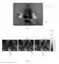 Fig. 03 - SYSTEM AND METHOD FOR LOCATING AND QUANTIFYING A BIOMARKER FOR NEUROLOGICAL DISEASE