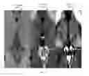Fig. 05 - SYSTEM AND METHOD FOR LOCATING AND QUANTIFYING A BIOMARKER FOR NEUROLOGICAL DISEASE