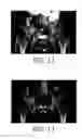Fig. 11 - Detection of bone tissue using magnetic resonance imaging