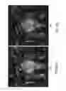 Fig. 07 - Compensated magnetic resonance imaging system and method for improved magnetic resonance imaging and diffusion imaging
