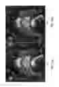 Fig. 08 - Compensated magnetic resonance imaging system and method for improved magnetic resonance imaging and diffusion imaging