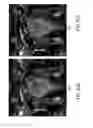 Fig. 09 - Compensated magnetic resonance imaging system and method for improved magnetic resonance imaging and diffusion imaging