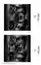 Fig. 10 - Compensated magnetic resonance imaging system and method for improved magnetic resonance imaging and diffusion imaging