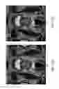 Fig. 12 - Compensated magnetic resonance imaging system and method for improved magnetic resonance imaging and diffusion imaging
