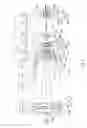 Fig. 04 - Zoom lens