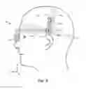 Fig. 04 - HEADSET HAVING VERSATILE EYE ORIENTATION ADJUSTMENT SYSTEM