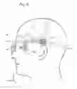 Fig. 09 - HEADSET HAVING VERSATILE EYE ORIENTATION ADJUSTMENT SYSTEM