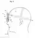 Fig. 10 - HEADSET HAVING VERSATILE EYE ORIENTATION ADJUSTMENT SYSTEM