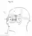Fig. 17 - HEADSET HAVING VERSATILE EYE ORIENTATION ADJUSTMENT SYSTEM