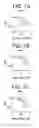 Fig. 08 - High plus treatment zone lens design for preventing and/or slowing myopia progression
