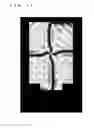 Fig. 12 - Liquid crystal display apparatus having four liquid crystal domains