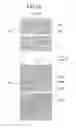 Fig. 17 - Liquid crystal display