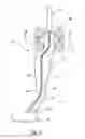 Fig. 04 - Two piece pedal arm