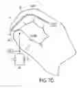 Fig. 17 - Glove interface object with thumb-index controller