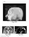 Fig. 22 - TARGETED ELECTRICAL STIMULATION