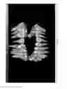 Fig. 30 - Electronic dental charting
