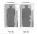 Fig. 07 - Method for the automatic recognition of anatomical structures in images obtained by positron emission tomography, system and computer program for performing said method