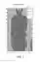 Fig. 08 - Method for the automatic recognition of anatomical structures in images obtained by positron emission tomography, system and computer program for performing said method