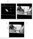 Fig. 01 - Concurrent display of medical images from different imaging modalities