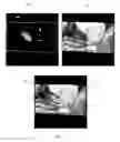Fig. 06 - Concurrent display of medical images from different imaging modalities