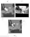 Fig. 08 - Concurrent display of medical images from different imaging modalities