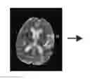 Fig. 01 - Method for volume evaluation of penumbra mismatch in acute ischemic stroke and system therefor